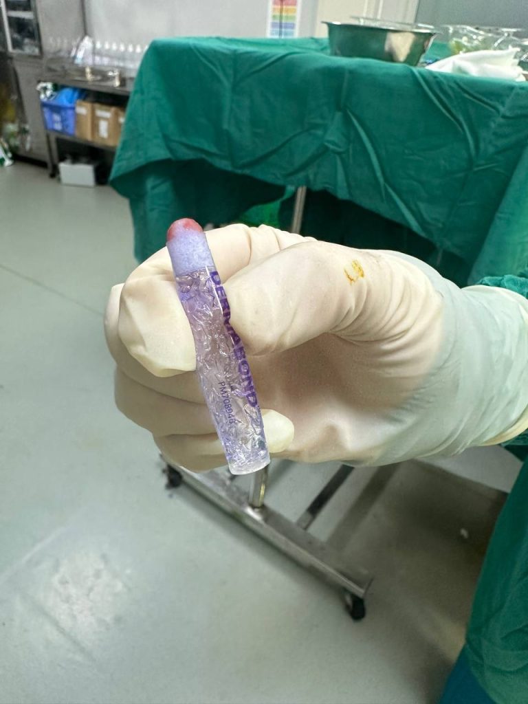 Keo dán sinh học dermanbond