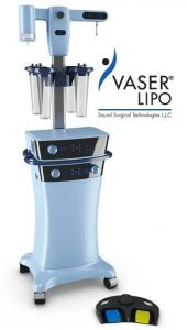 máy hút mỡ vaser lipo