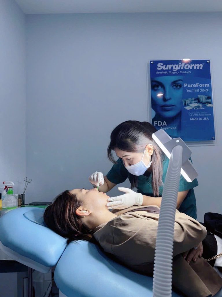 Cắt chỉ sau nâng mũi